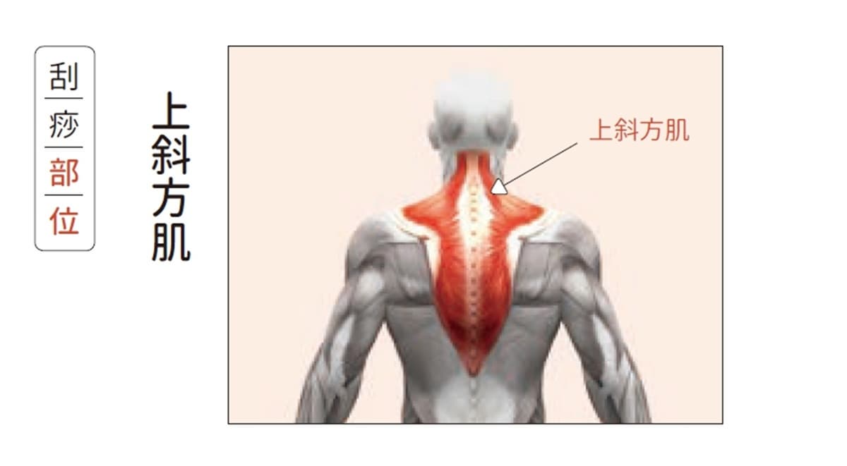 上班族毛病「刮痧」來救！治療師示範：落枕、睡不好，刮「這些」部位有效