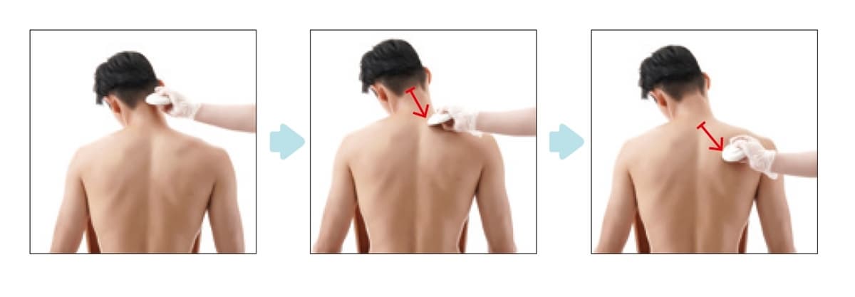 上班族毛病「刮痧」來救！治療師示範：落枕、睡不好，刮「這些」部位有效