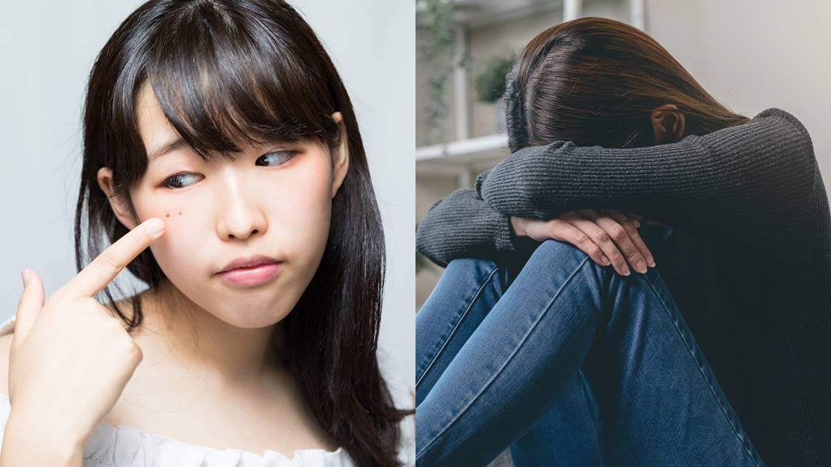 臉痣影響運勢?有「這2種痣」要小心,「點痣能轉運」命理專家解答曝光