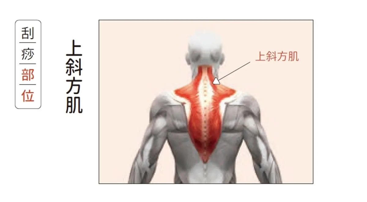 上班族毛病「刮痧」來救！治療師示範：落枕、睡不好，刮「這些」部位有效