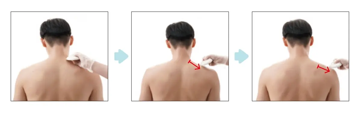 上班族毛病「刮痧」來救！治療師示範：落枕、睡不好，刮「這些」部位有效