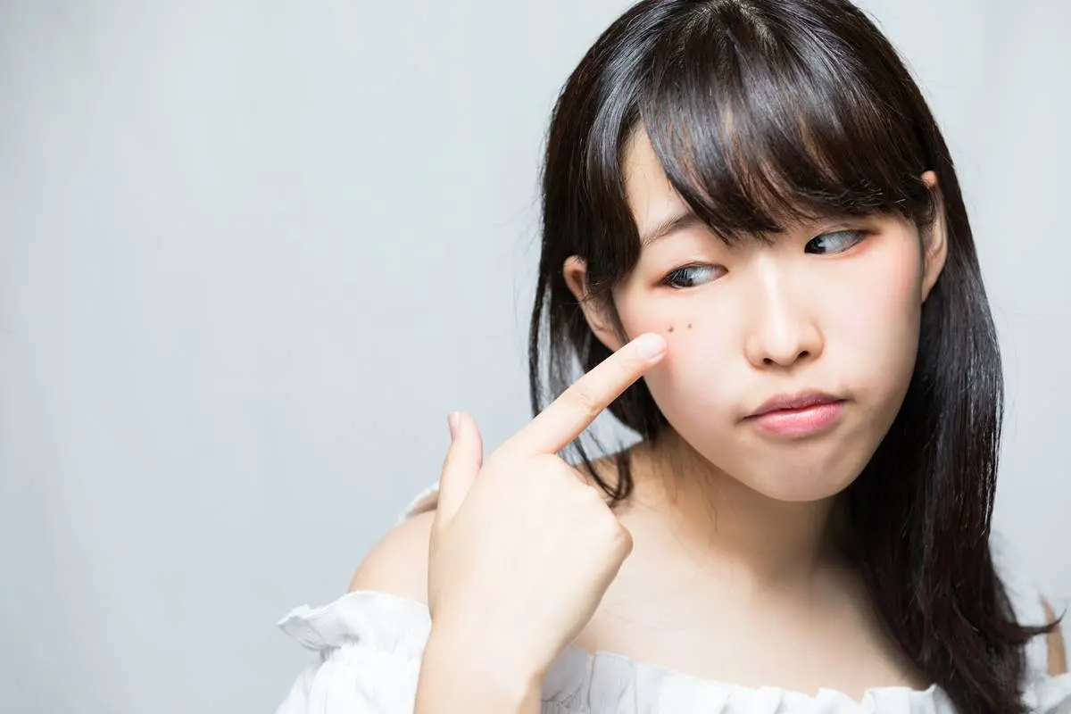 臉痣影響運勢?有「這2種痣」要小心,「點痣能轉運」命理專家解答曝光 臉痣影響運勢?有「這2種痣」要小心,「點痣能轉運」命理專家解答曝光